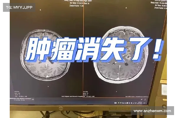 BianLian承认对波士顿儿童健康医生黑客攻击负责 媒体 BianLian承认对波士顿儿童健康医生黑客攻击负责 媒体